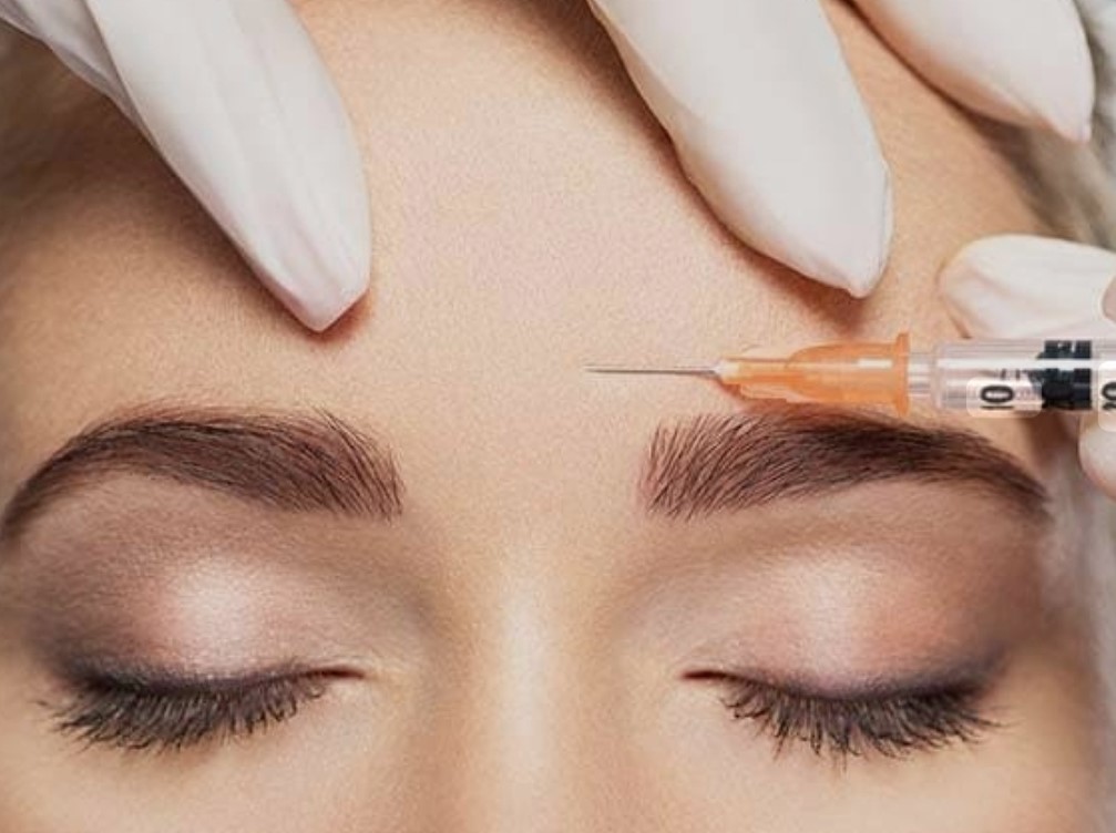 Aplicación de Toxina Botulínica Botox para suavizar arrugas dinámicas