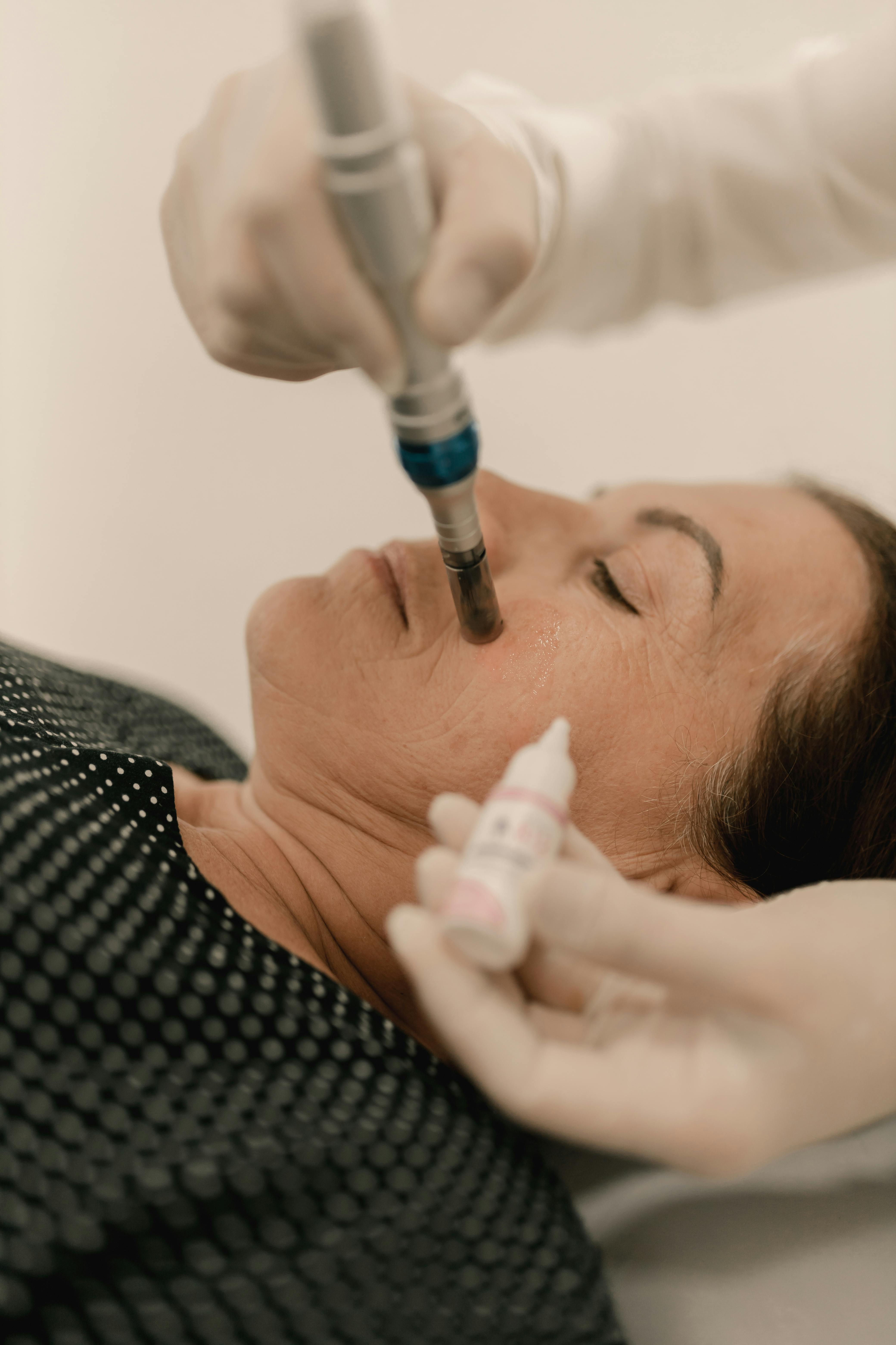 Tratamiento revitalizante de Dermapen con Vitaminas