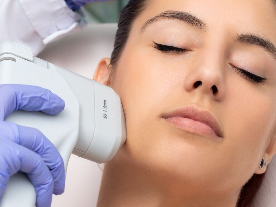 Efecto lifting natural con HIFU - Ultrasonido Focalizado de Alta Intensidad