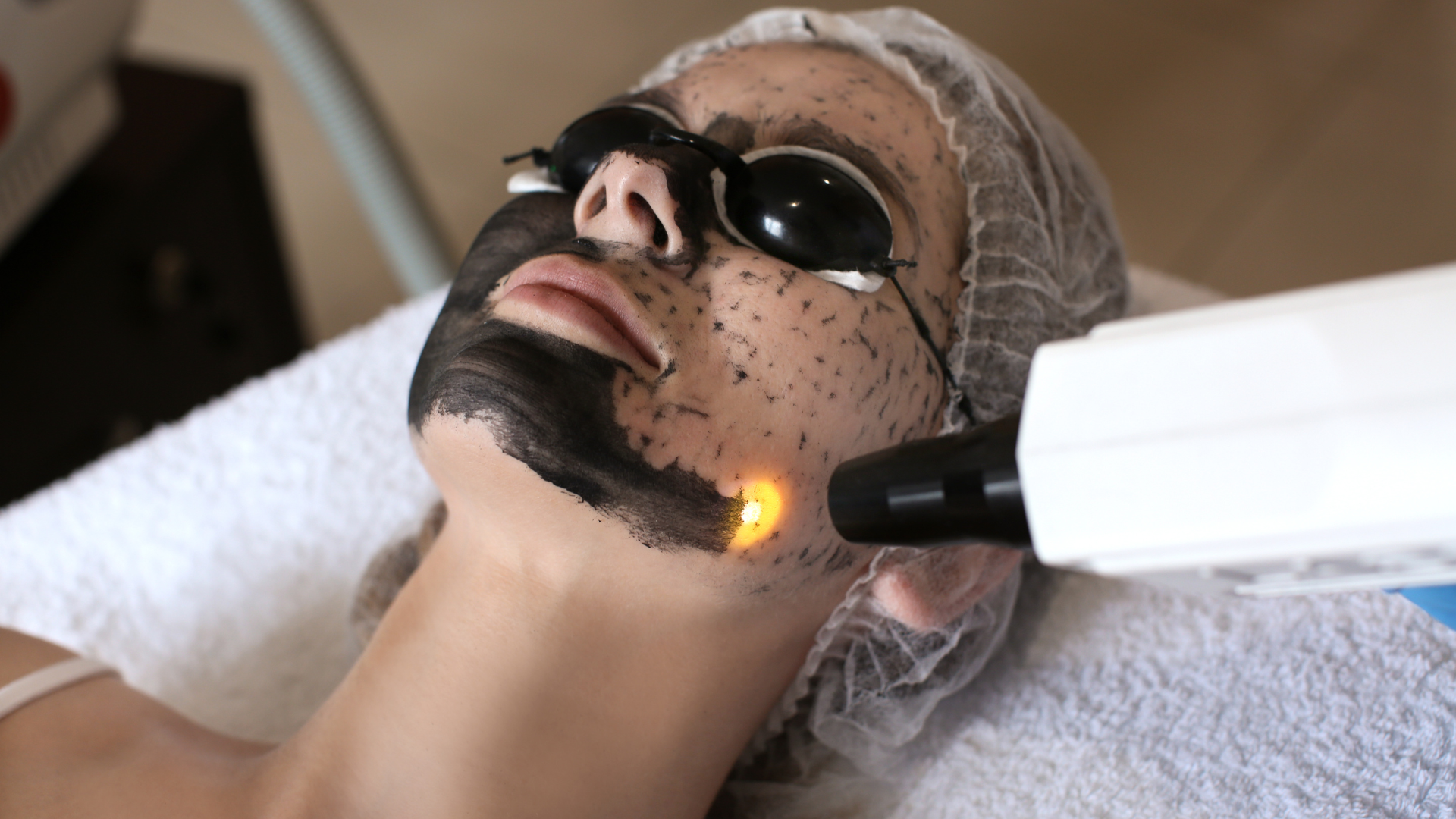 Hollywood Carbon Laser Peel para piel radiante y poros minimizados