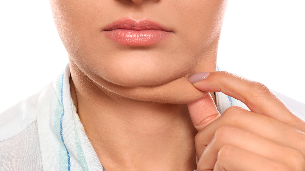 Reducción de papada y definición del contorno cervicofacial